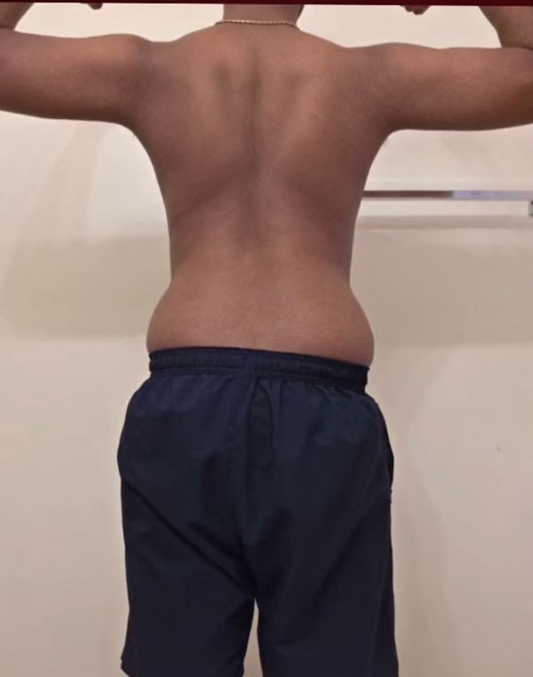 Naren after transformation